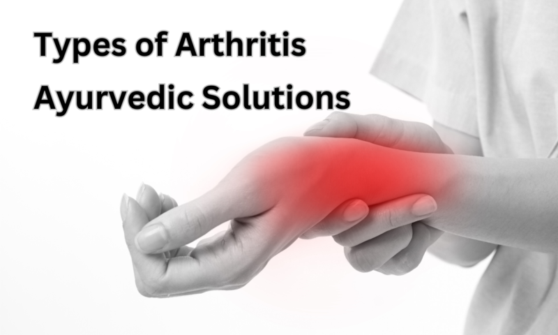 Arthritis Treatment